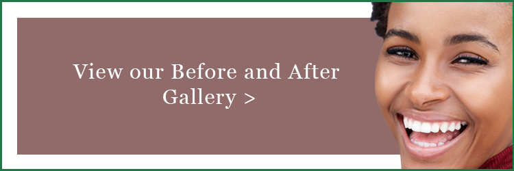 Before and After Banner